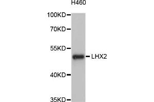 Western blot analysis of extracts of H460 cells, using LHX2 antibody (ABIN4904227) at 1:1000 dilution.