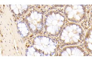 Immunohistochemistry (IHC) image for anti-Interleukin 17 Receptor D (IL17RD) (AA 157-299) antibody (ABIN7437776)
