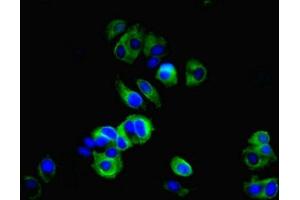 Immunofluorescent analysis of MCF-7 cells using ABIN7148290 at dilution of 1:100 and Alexa Fluor 488-congugated AffiniPure Goat Anti-Rabbit IgG(H+L) (TMEM27 antibody  (AA 15-141))