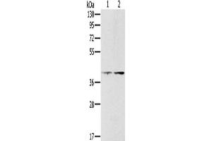 Gel: 8 % SDS-PAGE, Lysate: 40 μg, Lane 1-2: Hela cells, lovo cells, Primary antibody: ABIN7130569(PDGFRL Antibody) at dilution 1/400, Secondary antibody: Goat anti rabbit IgG at 1/8000 dilution, Exposure time: 10 minutes