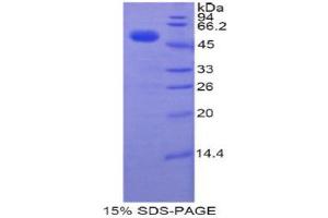 SDS-PAGE (SDS) image for Transcription Factor A, Mitochondrial (TFAM) (AA 43-246) protein (His tag,GST tag) (ABIN1878313) (TFAM Protein (AA 43-246) (His tag,GST tag))