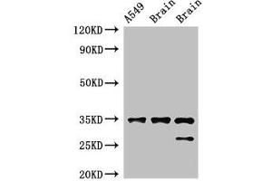 Western Blot Positive WB detected in: A549 whole cell lysate, Rat brain tissue, Mouse brain tissue All lanes: STUB1 antibody at 2 μg/mL Secondary Goat polyclonal to rabbit IgG at 1/50000 dilution Predicted band size: 35, 28 kDa Observed band size: 35, 28 kDa