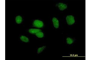 Immunofluorescence of purified MaxPab antibody to PB1 on HeLa cell.