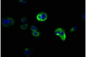 Immunofluorescence staining of MCF-7 cells with ABIN7169039 at 1:166, counter-stained with DAPI. (DCLK1 antibody  (AA 143-381))