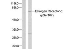 Western blot analysis of extracts from MCF7 cells treated with EGF, using Estrogen Receptor-alpha (Phospho-Ser167) Antibody. (Estrogen Receptor alpha antibody  (pSer167))