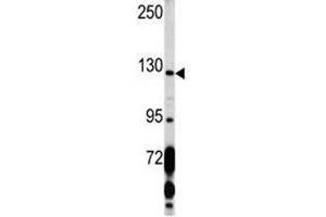 Western blot analysis of PDGFRA antibody and K562 lysate. (PDGFRA antibody  (AA 1048-1077))