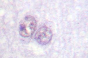 Image no. 1 for anti-Sp1 Transcription Factor (SP1) antibody (ABIN272083) (SP1 antibody)