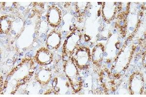 Immunohistochemistry (Paraffin-embedded Sections) (IHC (p)) image for anti-CDK5 Regulatory Subunit Associated Protein 1 (CDK5RAP1) antibody (ABIN7258736)