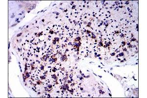 Immunohistochemical analysis of paraffin-embedded testis tissues using NQO1 mouse mAb with DAB staining. (NQO1 antibody)