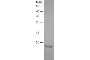 Chemokine (C-C Motif) Ligand 4 (CCL4) (AA 24-92) (Active) protein (His tag)