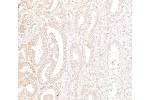 anti-WD Repeat Domain 91 (WDR91) (AA 350-400) antibody