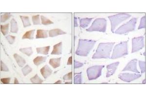 Immunohistochemistry analysis of paraffin-embedded human skeletal muscle tissue, using CRYAB (Ab-59) Antibody. (CRYAB antibody  (AA 31-80))