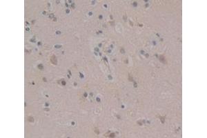 IHC-P analysis of Human Tissue, with DAB staining. (AXIN2 antibody  (AA 350-631))