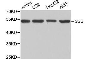 Western blot analysis of extracts of various cell lines, using SSB antibody (ABIN1874948) at 1:1000 dilution. (SSB antibody)