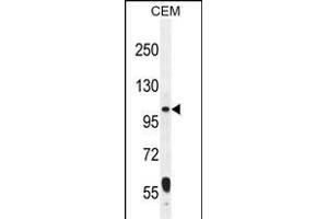 LARS2 Antibody (Center) (ABIN655050 and ABIN2844678) western blot analysis in CEM cell line lysates (35 μg/lane). (LARS2 antibody  (AA 418-446))