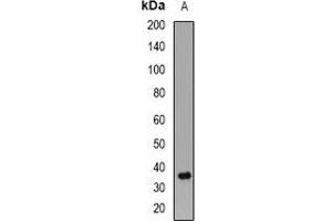 Western blot analysis of PPP2CB expression in Jurkat (A) whole cell lysates.