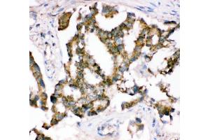 IHC analysis of Crk p38 using anti-Crk p38 antibody (ABIN3042758). (Crk antibody  (AA 2-246))