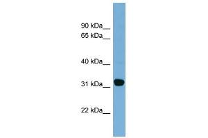 Carbonyl Reductase 1 antibody used at 1 ug/ml to detect target protein. (CBR1 antibody  (Middle Region))