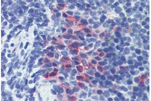 Mouse spleen: Formalin-Fixed, Paraffin-Embedded (FFPE) (CD11b antibody)