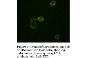 Image no. 2 for anti-ABL2 (ABL2) antibody (ABIN230671) (ABL2 antibody)
