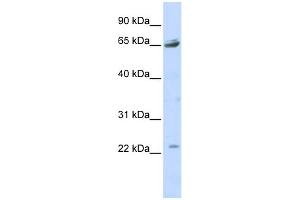 WB Suggested Anti-P2RX2 Antibody Titration:  0. (P2RX2 antibody  (Middle Region))