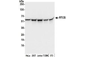 anti-tRNA-Splicing Ligase RtcB Homolog (RTCB) (AA 175-225) antibody