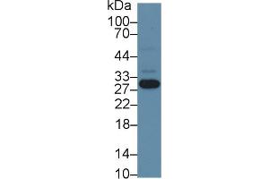 Western Blotting (WB) image for anti-Nicotinamide N-Methyltransferase (NNMT) (AA 1-258) antibody (ABIN7436480)