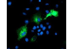 Immunofluorescence (IF) image for anti-Proteasome (Prosome, Macropain) 26S Subunit, Non-ATPase, 2 (PSMD2) antibody (ABIN1500481)
