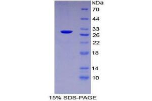 SDS-PAGE (SDS) image for SH2B Adaptor Protein 3 (SH2B3) (AA 335-561) protein (His tag) (ABIN2125740) (SH2B3 Protein (AA 335-561) (His tag))