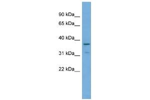 WB Suggested Anti-TOB1 Antibody Titration: 0. (Protein Tob1 (TOB1) (Middle Region) antibody)