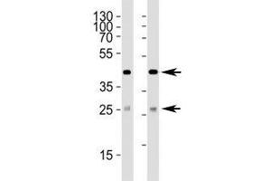 Western blot analysis of lysate from (1) 293 and (2) HepG2 cell line using SIRT3 antibody at 1:1000. (SIRT3 antibody  (AA 250-279))