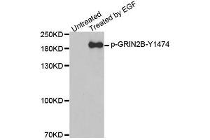 Western blot analysis of extracts from A431 cells, using Phospho-GRIN2B-Y1474 antibody (ABIN2988034). (GRIN2B antibody  (pTyr1474))