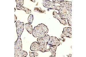 IHC analysis of U1A/SNRPA using anti-U1A/SNRPA antibody (ABIN7600891). (SNRPA1 antibody  (AA 25-218))