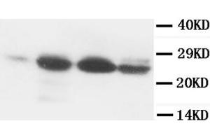 Western Blotting (WB) image for anti-B-Cell CLL/lymphoma 2 (BCL2) (AA 41-54) antibody (ABIN1105504)