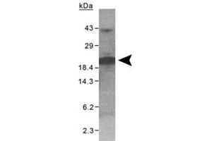Western blot analysis of XAGE1 on purified His-XAGE1 (100 ug) with XAGE1 polyclonal antibody . (XAGE1 antibody)