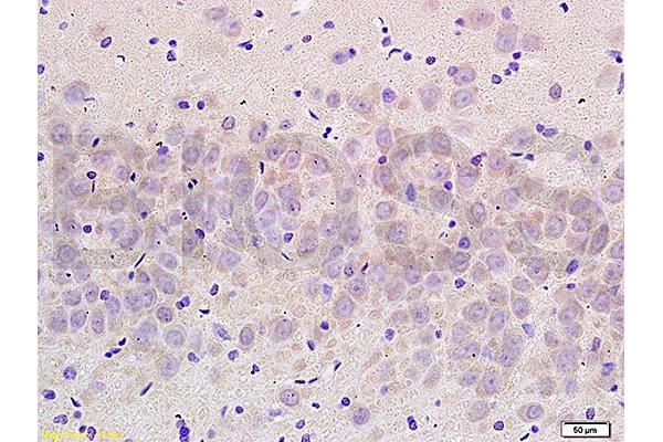 SLC8A2 antibody  (AA 601-700)