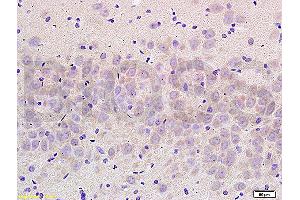 Formalin-fixed and paraffin embedded rat brain labeled with Anti- NCX2/SLC8A2 Polyclonal Antibody, Unconjugated (ABIN676478) at 1:200 followed by conjugation to the secondary antibody and DAB staining (SLC8A2 antibody  (AA 601-700))