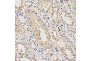 Immunohistochemistry of paraffin-embedded human kidney using DCTN2 antibody at dilution of 1:200 (x40 lens)