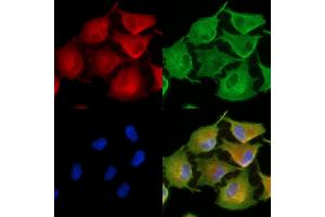 ABIN6262683 and ABIN6278907 staining  cells by IF/ICC. (ITGA8 antibody  (C-Term))