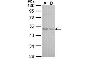 WB Image Sample (30 ug of whole cell lysate) A: A431 , B: H1299 10% SDS PAGE antibody diluted at 1:1000 (HRH3 antibody  (C-Term))