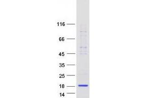 Lactalbumin, alpha- (LALBA) protein (Myc-DYKDDDDK Tag)