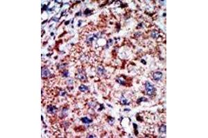 Image no. 2 for anti-Phosphofructokinase, Liver (PFKL) (C-Term) antibody (ABIN360629) (PFKL antibody  (C-Term))