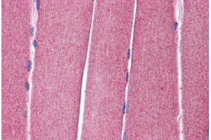 Human Skeletal Muscle: Formalin-Fixed, Paraffin-Embedded (FFPE) (Kv3.4 antibody  (AA 252-301))