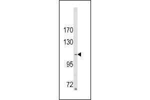 Western blot analysis of ARGBP2 Antibody (N-term) (ABIN652279 and ABIN2841160) in MDA-M cell line lysates (35 μg/lane). (Sorbs2 antibody  (N-Term))