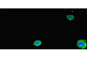 Immunofluorescent analysis of HepG2 cells using ABIN7171544 at dilution of 1:100 and Alexa Fluor 488-congugated AffiniPure Goat Anti-Rabbit IgG(H+L)