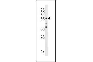Western Blotting (WB) image for anti-Cell Division Cycle 25 Homolog A (S. Pombe) (CDC25A) (AA 57-84) antibody (ABIN3030443)
