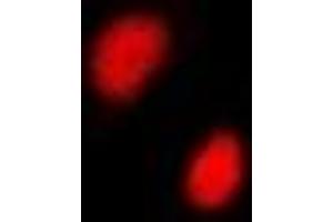 Immunofluorescent analysis of CGBP staining in A549 cells. (CXXC1 antibody)
