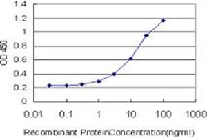 Detection limit for recombinant GST tagged ESR2 is approximately 0. (ESR2 antibody  (AA 22-121))