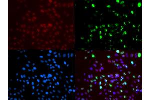 Immunofluorescence analysis of GFP-RNF168 trangenic U2OS cell using MSH6 antibody. (MSH6 antibody)