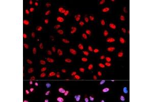 Immunofluorescence analysis of U2OS cells using Phospho-ESPL1(S1126) Polyclonal Antibody (Separase antibody  (pSer1126))